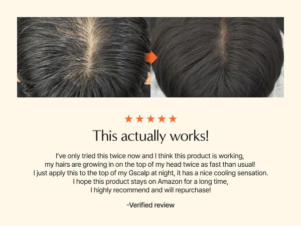 Growturn Hair Serum with Brush