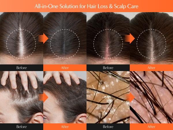 Growturn Hair Serum with Brush